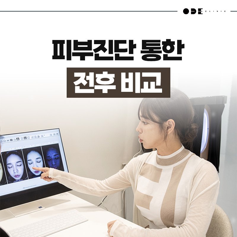江南高品質 XERF 療程